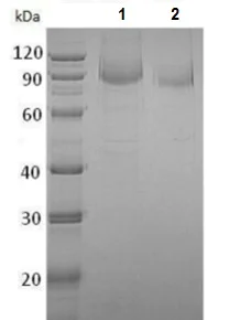 SDS-PAGE - Recombinant Human ErbB2 / HER2 protein (His tag) (AB215657)