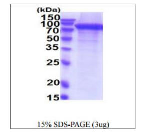 SDS-PAGE - Recombinant Human ErbB2 / HER2 protein (His tag) (AB270572), expandable thumbnail