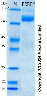 SDS-PAGE - Recombinant Human ErbB2 / HER2 Protein Standard (AB316697)