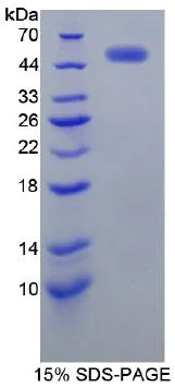 SDS-PAGE - Recombinant Human ErbB2 / HER2 protein (Tagged) (AB270597)