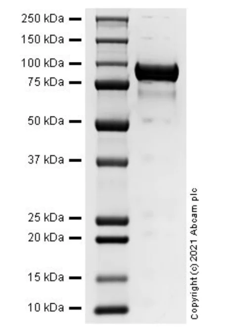 SDS-PAGE - Recombinant human ErbB3 / HER3 protein (AB283452)