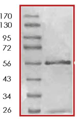 SDS-PAGE - Recombinant human ErbB4 / HER4 protein (AB85602)