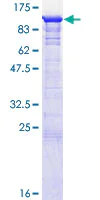 SDS-PAGE - Recombinant Human eRF3/GSPT1 protein (AB132287)