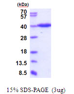 SDS-PAGE - Recombinant Human ERGIC3 protein (His tag N-Terminus) (AB202224)