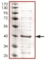 SDS-PAGE - Recombinant Human ERK1 (mutated K71A) protein (His tag N-Terminus) (AB125557)