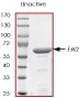 SDS-PAGE - Recombinant Human ERK2 protein (AB43624)