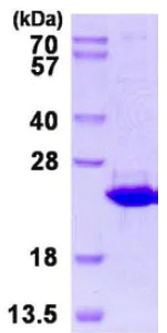 SDS-PAGE - Recombinant Human ERp18 protein (DDDDK tag N-Terminus + His tag N-Terminus) (AB128439)