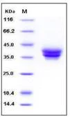 SDS-PAGE - Recombinant Human ESAM protein (His tag) (AB276221)