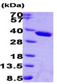 SDS-PAGE - Recombinant Human ESD protein (AB87688)