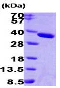 SDS-PAGE - Recombinant Human ESD protein (AB87688)