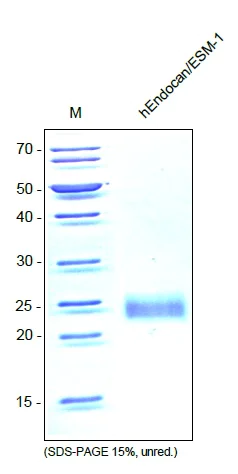 SDS-PAGE - Recombinant Human ESM1 protein (AB129132)