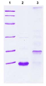 SDS-PAGE - Recombinant Human Estrogen Inducible Protein pS2 (AB89485)