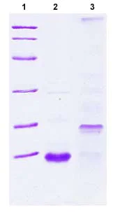 SDS-PAGE - Recombinant Human Estrogen Inducible Protein pS2 (AB89485)