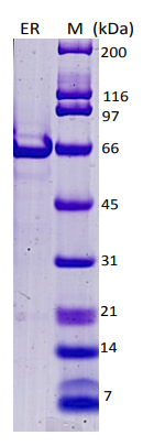 SDS-PAGE - Recombinant Human Estrogen Receptor alpha protein (AB82606), expandable thumbnail