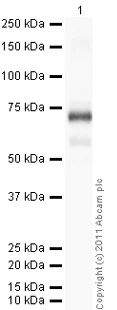 Western blot - Recombinant Human Estrogen Receptor alpha protein (AB82606)