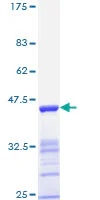 SDS-PAGE - Recombinant Human Estrogen Receptor beta protein (GST tag N-Terminus) (AB114181)