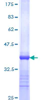 SDS-PAGE - Recombinant Human Estrogen Related Receptor alpha protein (AB152370)