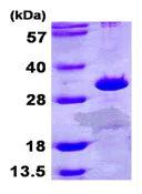 SDS-PAGE - Recombinant Human ETFB protein (AB107152)