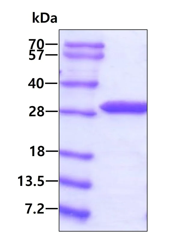 SDS-PAGE - Recombinant Human ETHE1 protein (His tag N-Terminus) (AB119454)