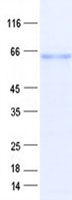 SDS-PAGE - Recombinant Human ETS1 protein (His tag) (AB314596), expandable thumbnail