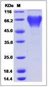 SDS-PAGE - Recombinant Human EVI2A protein (Fc Chimera) (AB276658)