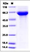 SDS-PAGE - Recombinant Human EWI-2 protein (His tag) (AB276541)