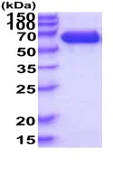 SDS-PAGE - Recombinant Human EWI-2 protein (His tag C-Terminus) (AB222989)