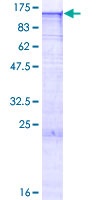 Recombinant Human EXOSC10/RRP6 protein