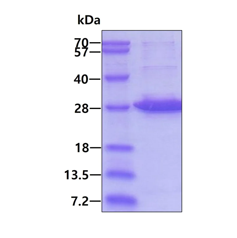 SDS-PAGE - Recombinant Human EXOSC5/CML28 protein (His tag N-Terminus) (AB124595)