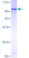 Western blot - Recombinant Human Extracellular matrix protein 1 (GST tag N-Terminus) (AB152353)