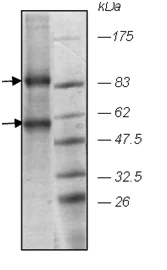 SDS-PAGE - Recombinant Human EZH2 + EED protein (AB198080)
