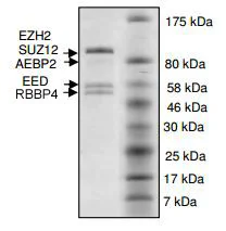 SDS-PAGE - Recombinant Human EZH2 + EED + SUZ12 + AEBP2 + RBBP4 (mut A692V) protein (His N-Term, DDDDK N-Term) (AB196423)