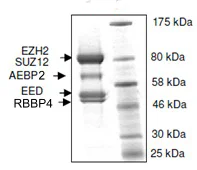 SDS-PAGE - Recombinant Human EZH2 + EED + SUZ12 + AEBP2 + RBBP4 (mut Y646C) protein (DDDDK N-Term, His N-Term) (AB135011)