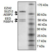 SDS-PAGE - Recombinant Human EZH2 + EED + SUZ12 + AEBP2 + RBBP4 (mutated A692V) protein (AB196423), expandable thumbnail