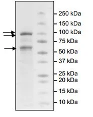 SDS-PAGE - Recombinant human EZH2 + EED + SUZ12 protein (6x His tag N-Terminus, DDDDK tag N-Terminus) (AB196409)