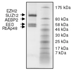 SDS-PAGE - Recombinant Human EZH2 (mut Y641H) + EED + SUZ12 + AEBP2 + RBBP4 protein (His N-Term, DDDDK N-Term) (AB198082)