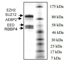 SDS-PAGE - Recombinant Human EZH2 (mutated Y641S) + EED + SUZ12 + AEBP2 + RBBP4 protein (AB198136)