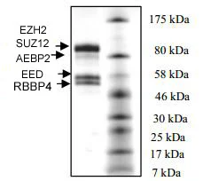 SDS-PAGE - Recombinant Human EZH2 (Y641S) + EED + SUZ12 + AEBP2 + RBBP4 protein (6xHis N-Term, DDDDK N-Term) (AB198136)