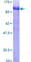SDS-PAGE - Recombinant Human Ezrin protein (AB132942)