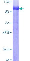 SDS-PAGE - Recombinant Human Ezrin protein (AB132942)