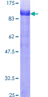 SDS-PAGE - Recombinant Human Ezrin protein (GST tag N-Terminus) (AB132942)