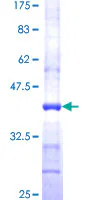 SDS-PAGE - Recombinant Human FAAH1 protein (AB114426)