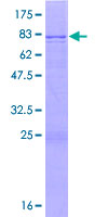 SDS-PAGE - Recombinant Human FAAH2 protein (AB165703), expandable thumbnail
