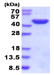 SDS-PAGE - Recombinant human FABP-1 protein (His tag N-Terminus) (AB206788)