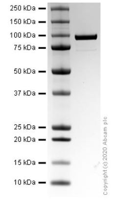 SDS-PAGE - Recombinant Human Factor B protein (AB274645)