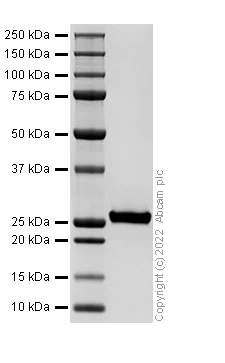 SDS-PAGE - Recombinant Human Factor D/CFD Protein (His tag) (Active) (AB307479)