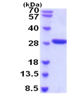 SDS-PAGE - Recombinant Human Factor D/CFD protein (His tag C-Terminus) (AB202242)
