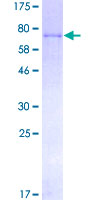 Recombinant Human Factor IX/PTC protein