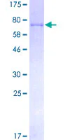 SDS-PAGE - Recombinant Human Factor IX/PTC protein (GST tag N-Terminus) (AB158405)