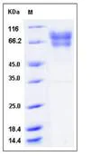 SDS-PAGE - Recombinant Human Factor IX/PTC protein (His tag) (AB276396)